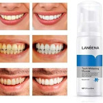 Lanbena Teeth Whitening Mousse 60ML